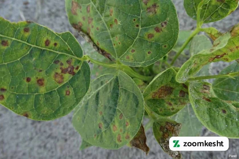 سوختگی باکتریایی لوبیا